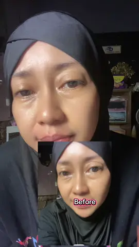 Tiap chekout langsung dua, sekalap itu aku sama korektor satu ini, juara banget sih #kantongmata #lingkarhitam #garissenyum #mizzu #skincareoutine #fyppppppppppppppppppppppp 