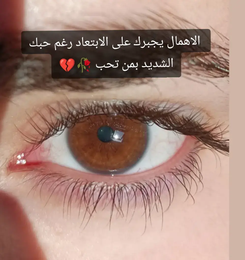 #رفقأ_بمن_تحبون💔😭  #حطام💔 ــہہہــــــــــہہـ 💔  #تبآ_للكسور_التي_لاتجبر🥀