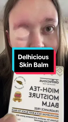 #balm #skincare #facescar #scar #flap #skinflap #facecare #skincareroutinetips #skincareroutines #fyp #fyou #tiktokmademebuyit #superdrug this product is wonderful and I recommend you try it for yourself and research the company and the other things they sell 100% vegan, fragrant free ans award winning x