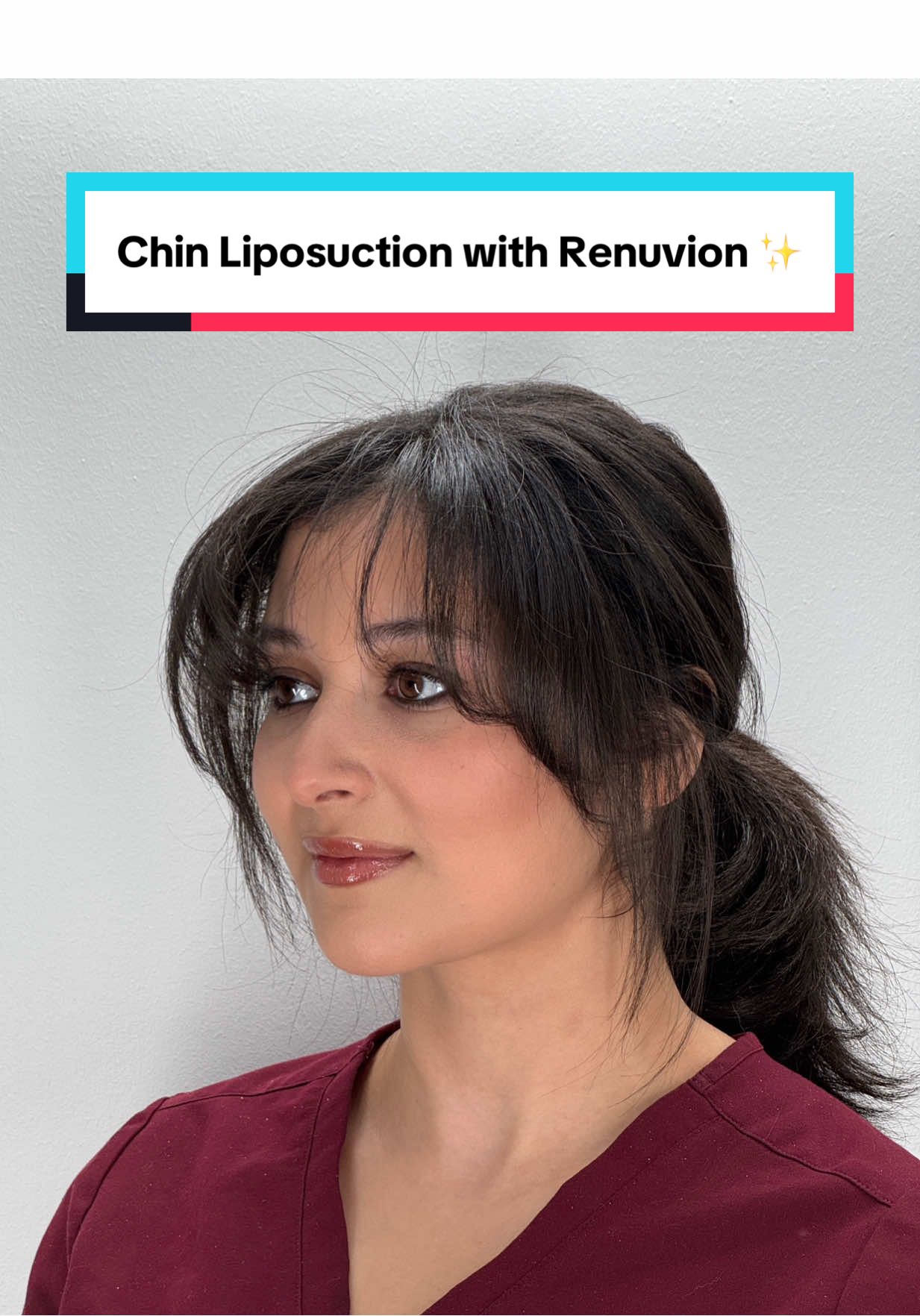 Chin liposuction with Renuvion by Dr. Lyly 😍🔥 Our beautiful patient has achieved a noticeably defined and contoured jawline following chin liposuction with Renuvion. A subtle yet powerful enhancement at 5 months post-op! #chinliposuction #plasticsurgeon #cosmeticsurgery #surgery #beforeandafter  #vadoplasticsurgery #fyp #plasticsurgerytok #plasticsurgeon #plasticsurgery  #surgeontok #chinlipo #chinsurgery #liposuction #lipo #renuvion #skintightening 