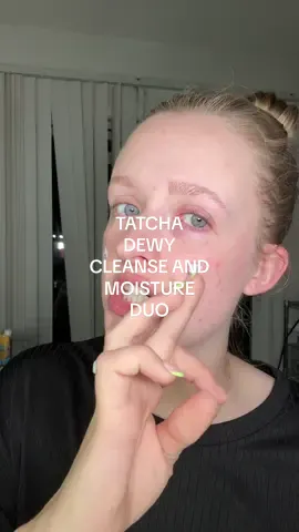 Dewy, glowing skin for $27? Yes please 💜 This luxe Tatcha duo includes the Rice Wash cleanser + Dewy Skin Cream — your glow-up essentials in one skincare set. Only on TikTok Shop & shipping’s FREE for a limited time ✨ #Tatcha #DewySkin #RiceWash #DewySkinCream #GlowingSkinRoutine #TikTokShopFinds #LuxurySkincare        