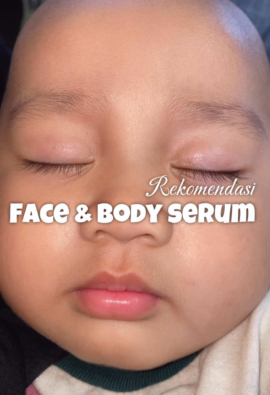 Asli kaget banget setelah rutin pake lotion serum dari @GLOWKIDS  #skincare #anak #bayilucugemes #lotionviral #glowkids 