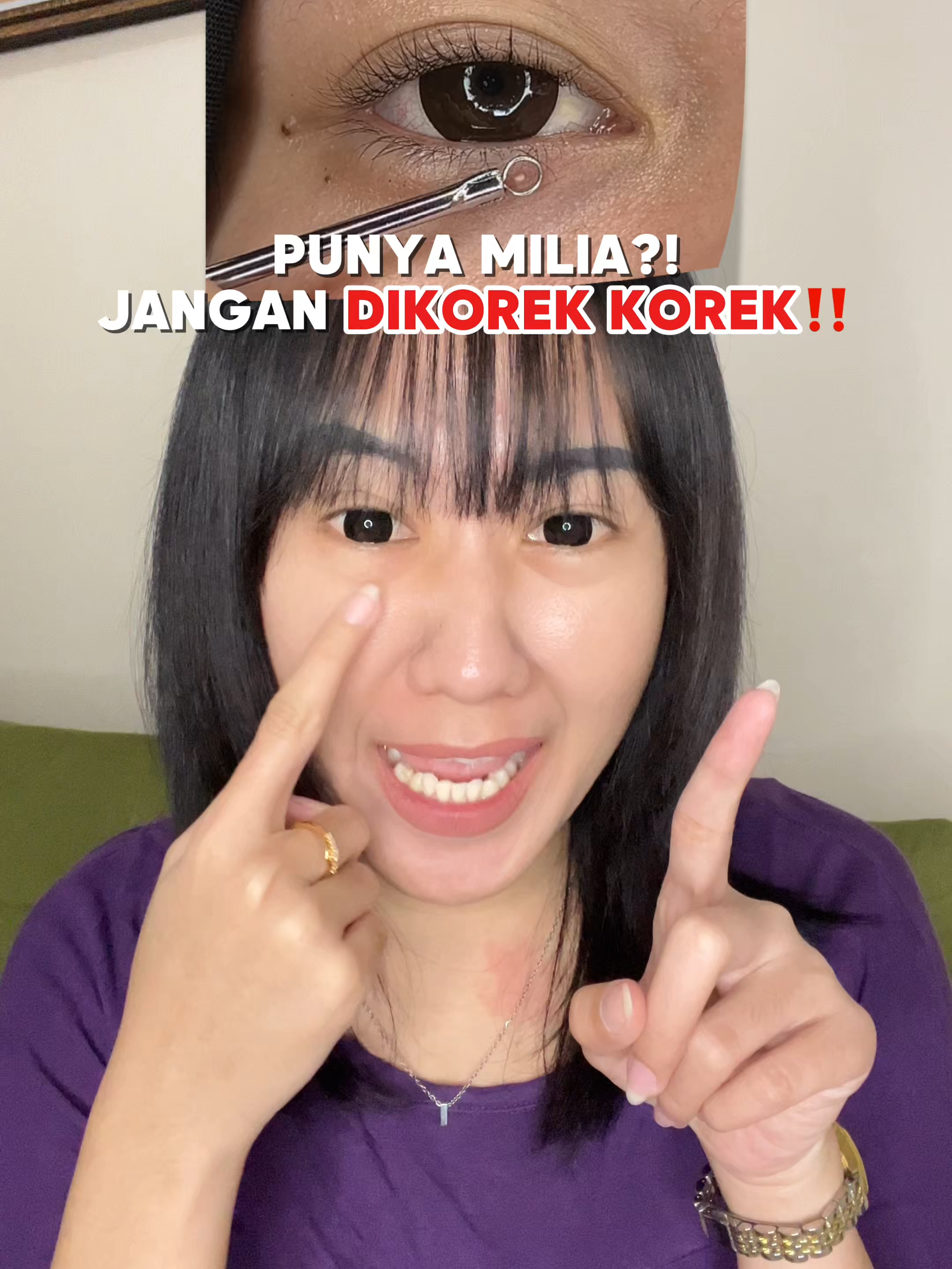 Jangan dikorek korek karena bisa nimbulin bekas bopeng nantinya😫🫵🏻 #leikaskincare #PromoGuncang77