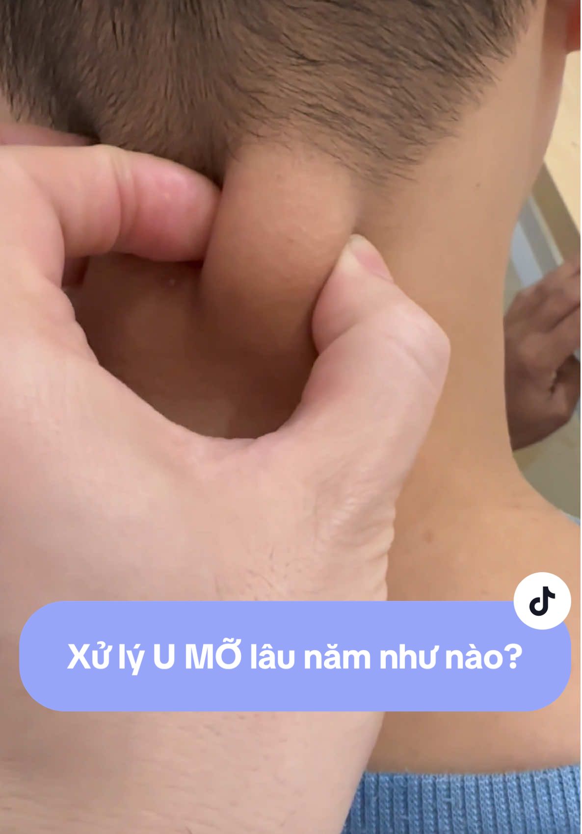 Cách xử lý u mỡ lâu năm. #suckhoe247goclamdep #suckhoechomoinguoi #bacsityungbuou #LearnOnTikTok #viral #utuyenba 