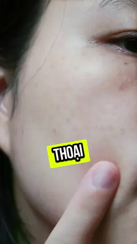 Can đảm tắt filter đi và cái kết #luxurymelasmacream #reviewlamdep #goclamdep #matmoc #BeautyTok #nhamochuong #mocmocthienhuong 