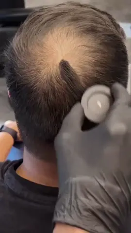 Sabe aquele truque que realça a linha do cabelo e disfarça as falhas em segundos? Esse é o Hair Shadow em pó da JHESSY, uma maquiagem capilar leve, à prova d’água, suor e vento, que deixa o visual natural e duradouro. Perfeito pra cobrir entradas, disfarçar falhas na raiz e dar aquele volume visual — sem deixar o couro cabeludo oleoso. Não obstrui os folículos e sai facilmente com shampoo. Hoje tá saindo por R$ 39,00 com frete grátis pra seguidores aqui na TikTok Shop. Não perde, porque esse é o tipo de achado que viraliza e esgota rápido. #tiktokshop #achadinhosdebeleza #hairshadow 