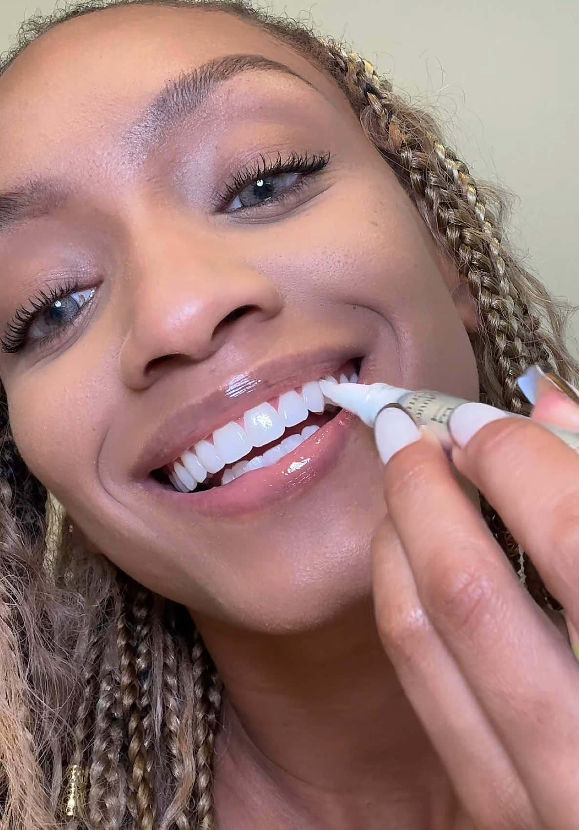 You don’t have to have yellow teeth, we got options baby! 😁  #gurunanda #teethwhitening #gurunandawirelesswhiteningnewarrival #dealsforyoudays #whiteteeth #whiteningstrips @GuruNanda LLC @Puneet Nanda bridge the gap 