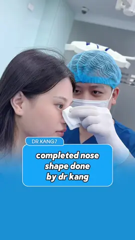 Newly completed nose job done by Dr Kang #drkang #ftypシ #kualalumpur #malaysia #rhinoplasty #perfectnose 