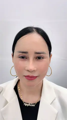 Lột Xa.c’ với Căng da cấy mỡ hạ size mí thay đổi khuôn mặt cho chị #cangda #caymo #hasizemi #catmi #xuhuong #lamdep #viral #thammyvien #phongkham 