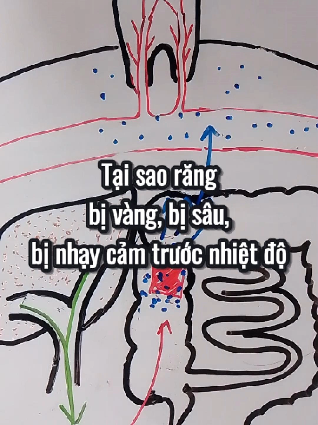 Tại sao răng vàng *Tôi không phải bác sĩ. Hãy có chính kiến riêng* #kienthuc #chiase #chiasekinhnghiem #hanhphuc #suckhoechomoinguoi #suckhoe #rangmieng #saurang #mau #vikhuan #ductin #tinhyeu #hyvong #teeth #giupdo #giupdonguoikhac