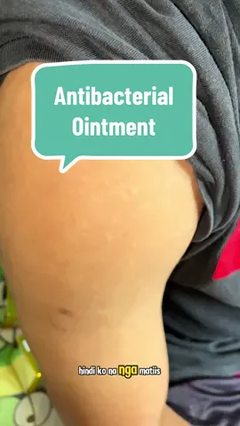 Wag Hayaan Lumala! Gamutin Agad with Bai Yao Lang Antibacterial Ointment! #BaiYaoLangOintment #AntibacterialCare #MabisangGamot #SkincarePH #TikTokFindsPH #antibacterialointment #creatorsearchinsights  #eczema 