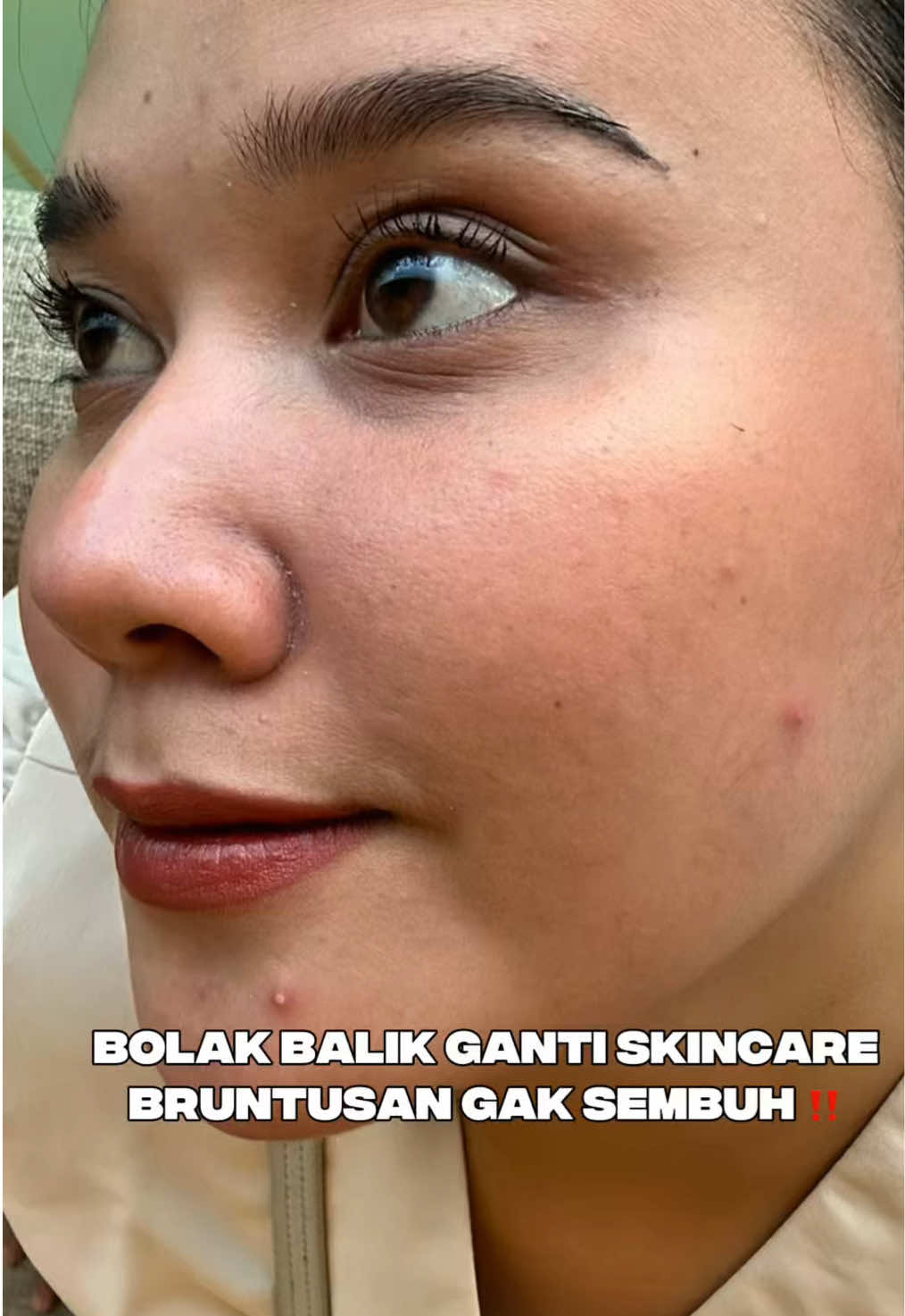 Bolak balik ganti skincare, brentusan gak sembuh2‼️ untung ada ini👀👌🏻 #peelingserum #elformula 