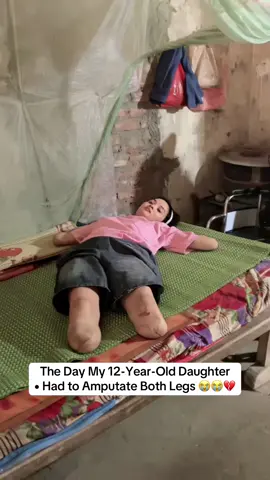 pray for my daughter 💔😭 #daug #legs #surgery #amputation #mother #hospital #women 