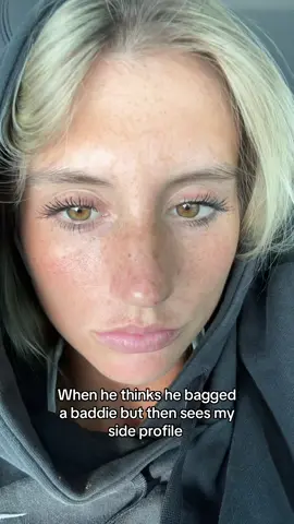 Its ok im getting a rhinoplasty December 