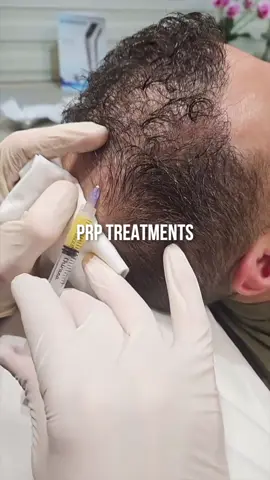 PRP is a game changer for your hair ✨ Credit: @kiyana <3  #renewoklahoma #aesthetics #haircare #hairloss #hair