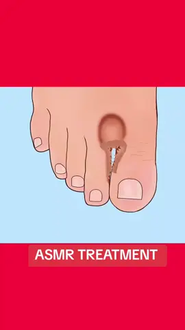 ##usa🇺🇸 #asmrtreatment #usa🇺🇸 #beautyasmr #usa🇺🇸 #asmrtreatment #usa🇺🇸 #usa🇺🇸 #beautyasmr 