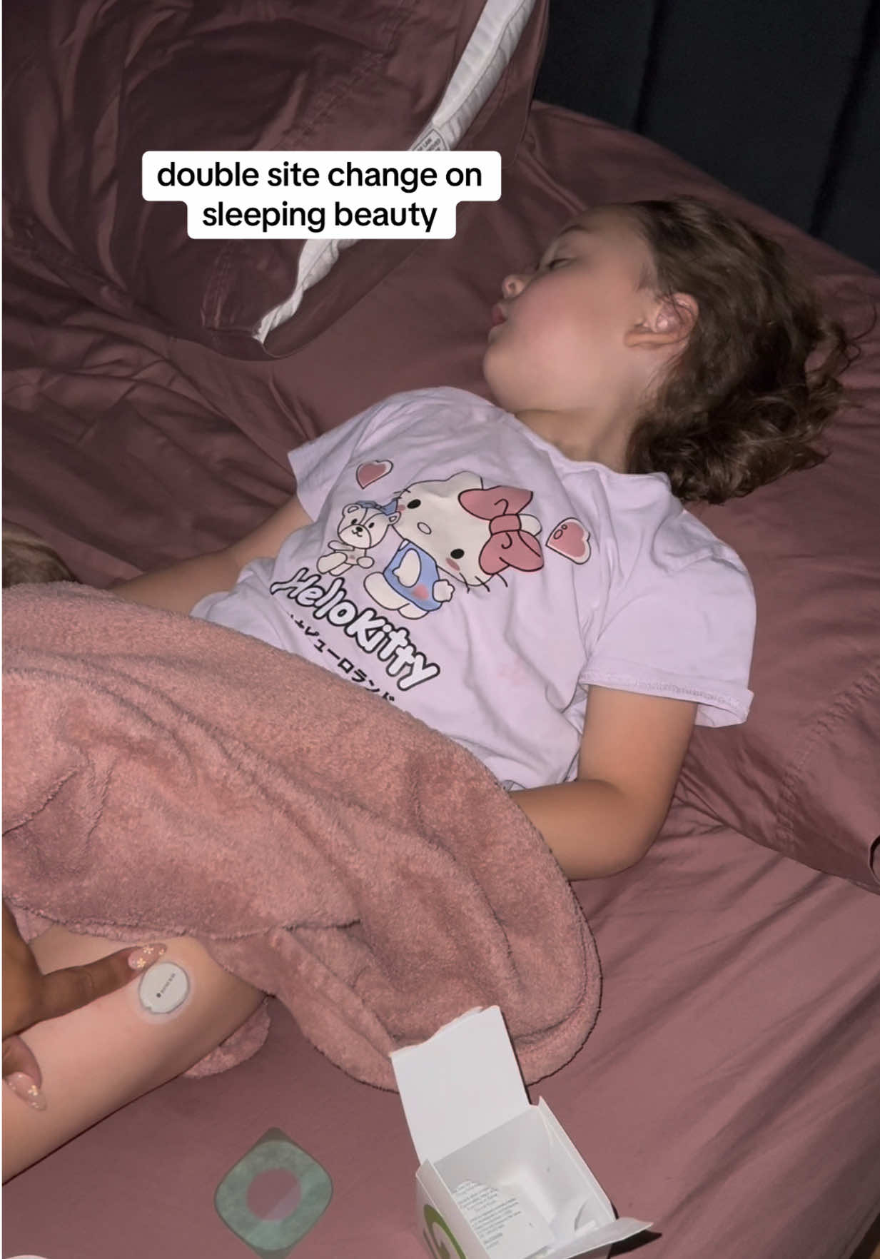 thank god she sleeps through it (mostly) #t1d #doublesitechange #type1diabetes #dexcom #omnipod #type1 #t1dmom #t1dlife #asmr #asmrsounds #momlife #fyp 
