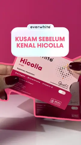 Pernah sekusam itu sebelum kenal Hicolla Capsule 😭 #everwhite #hicollacapsule #glowing #suplemenkolagen #collagen