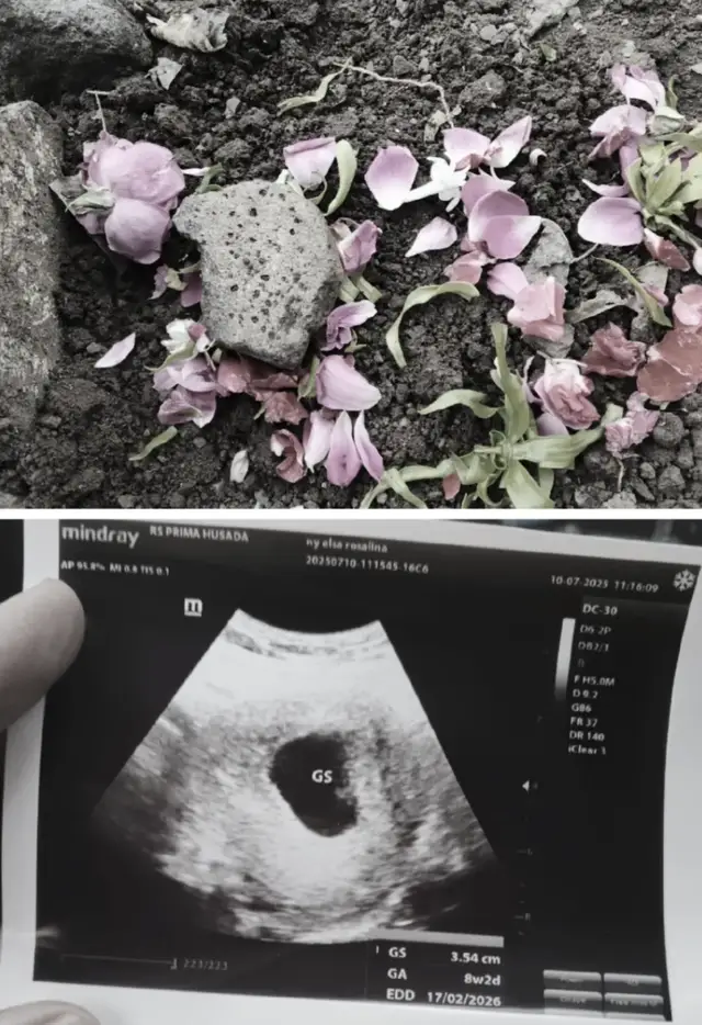 terimakasih sudah ada di rahim mama walau hanya 8 Minggu nak🥺 #kehilangan  #anaksurgaku  #keguguran2bln 