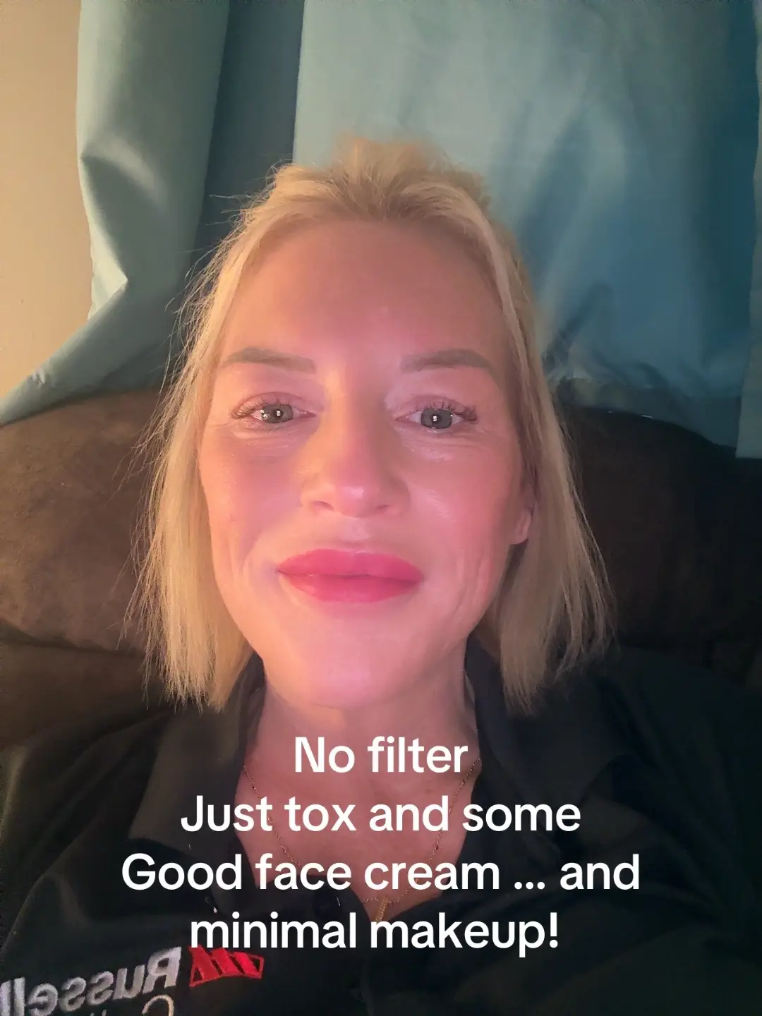 No filter just tox and minimal makeup! #dyp #tox #DIY #foryoupage❤️ #viral