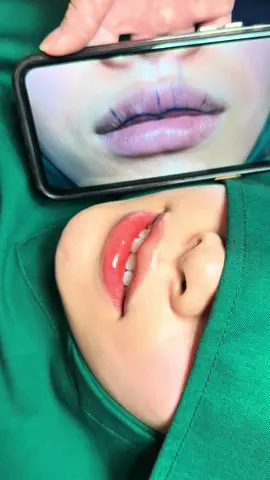 +1 máy cắt môi đẹp #xuhuongtiktok #viralreelschallenge2024 #trending #cắtmôi #cắtmôidày #tạo_hình_môi #cắt_môi_dày  