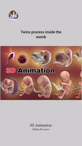 Twins process inside the womb. #onlyforyou #1millionaudition #fyp #pregnancy #foryouofficial #drzainab652 #foryoupage @doctor Saima 👩🏻‍⚕️ @Dr sana yousaf 🩺 @Doctor Nimra 🩺 