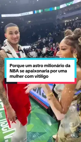 Porque um astro milionário da NBA se apaixonaria por uma mulher com vitiligo #curiosidades #brasil #brasil🇧🇷 