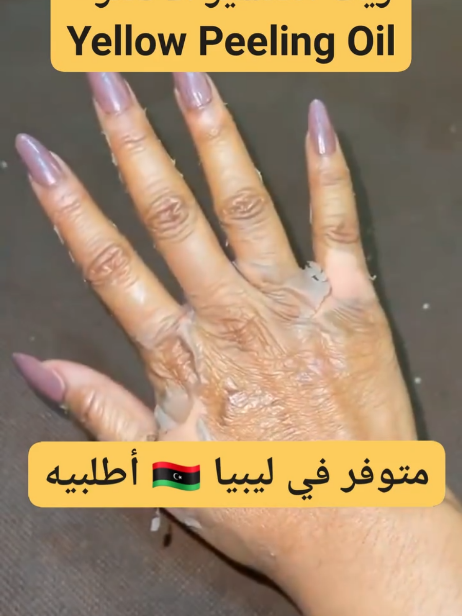 تقشير سريع وآمن على كل أنواع البشرة 😂😍 كانك عروسة جديدة وعرسك قريب لابد تديري الزيت إللي حيخلي راجلك مايعرفك من البياض 🤭  يقشّر بلطف خلايا الجلد الميت 😚 يوحّد لون البشرة ويقلل البقع الداكنة 🤩 يفتح البشرة بدرجات عالية 😍 يمنحك إشراقة صحية خلال أيام 😊 مناسب لجميع أنواع البشرة يعالج الكلف ويفتح المناطق ال 🤭 يعالج الحبوب وأثار الحبوب  يعالج النمش  للوجه والرقبة والإبطين والكوعين واليد والضهر والركب والرجلين 🤗 صنع بتركيبة فعالة وآمنة آمن على البشرة الحساسة  نتائج ملحوظة خلال أول أسبوع من الإستخدام لا يسبب جفافًا ولا تهيجًا 😍 عندنا توصيل لكل مناطق ليبيا 🇱🇾 يمكنك الطلب من خلال صفحتنا ✅ #ليبيا #ليبيا_طرابلس_مصر_تونس_المغرب_الخليج #تقشير #زيت #تجميل 