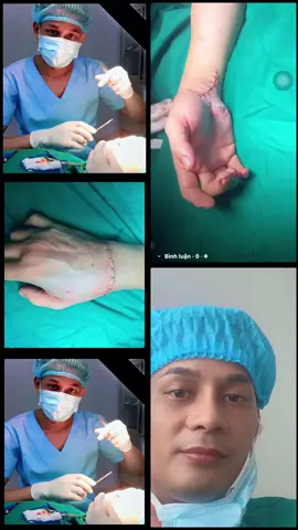 Đây là Anh Hùng của thời bình .. thiên tài của dấtd nước  Chân dung Bác sỹ Ngọc Sơn Tùng, đến từ bệnh viện trung ương Thái Nguyên. Người giúp tiktoker Hà Lít nối lại hai bàn tay, như chưa hề có cuộc 