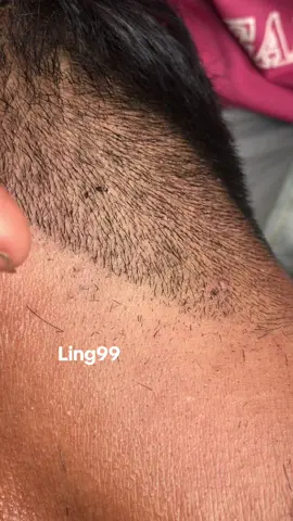 get rid of his lice#😭😭🥰🥰😱😱🤮🤮🥶🥶 #lice #liceremoval #omg 