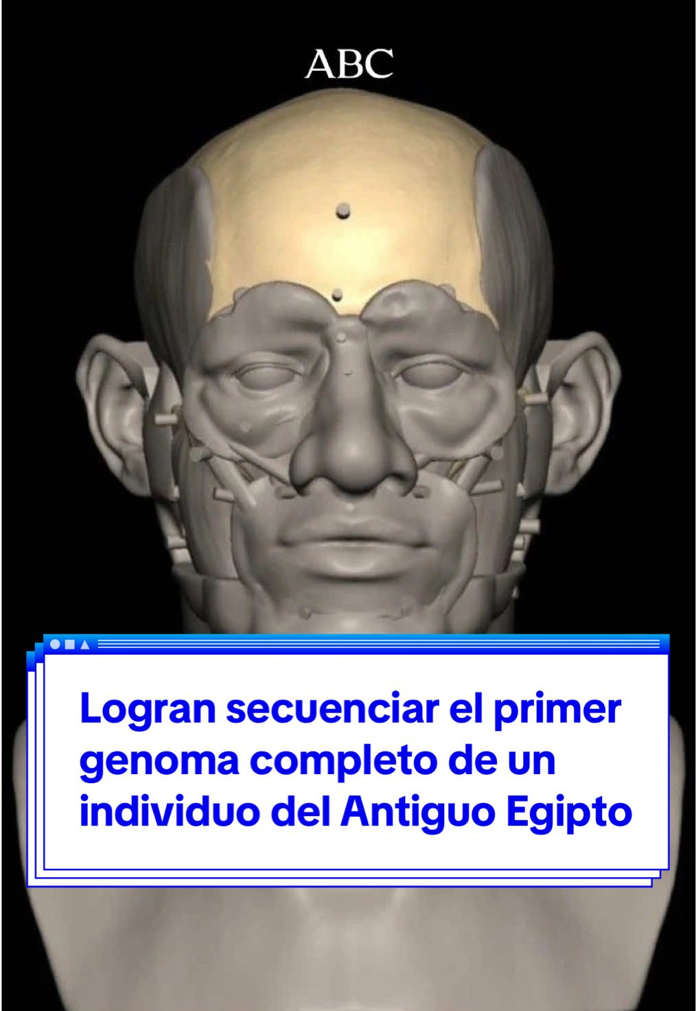 🔬 Un equipo del Instituto Francis Crick y la Universidad John Moores de Liverpool (LJMU) ha logrado secuenciar el primer genoma completo de un individuo del Antiguo Egipto. Llegó a los 60 años y las marcas de sus huesos indican que ejercía un trabajo duro, probablemente como alfarero 🦠 La muestra de ADN, la más antigua de Egipto, revela que el individuo estaba emparentado con pueblos del creciente fértil, un área de Asia Occidental que abarca los actuales Irak, Irán y Jordania 🗣️ Te contamos más en ABC.es #Egipto #AntiguoEgipto #Egypt #InstitutoFrancisCrick #Liverpool #científicos #Science #ADN #DNA #genoma 
