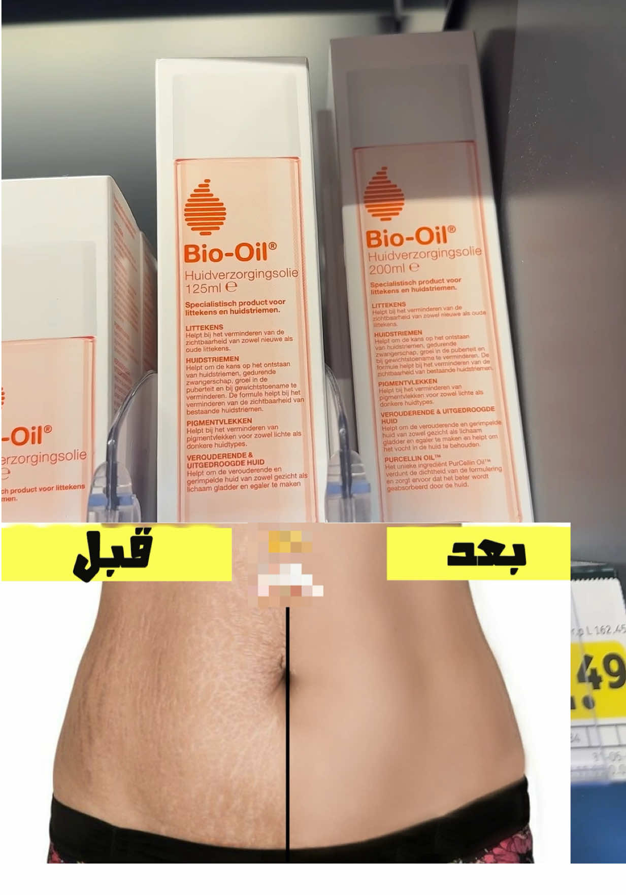 #creatorsearchinsights #rasharazouk #explore #fyp #review #جمالك #عنايه #viral #infulencer #اكسبلور #foryou #تشققات_الحمل #biooil @Bio-Oil Official @Bio-Oil USA 