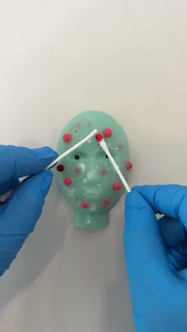 ASMR-pop a pimple #pimplepopping #oddlysatisfying #satisfying #asmr #fyp #diytoys 