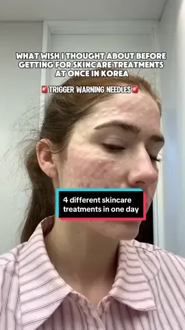 Wasn’t sure if I was going to post this… but I figured it was part of my journey. #rejuran #salmondnatreatment #skinlasertreatment #lasertreatments #koreanbeauty #koreaskinclinic #kbeauty #acnetreatment 