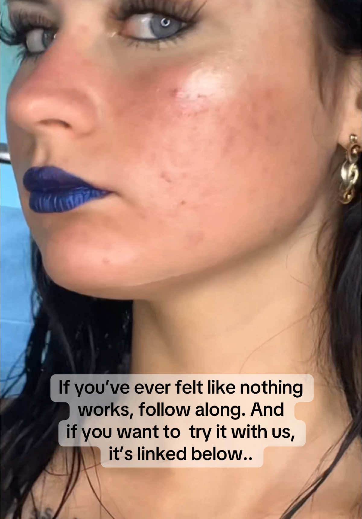 We heard the hype. We’re just testing it. One cheek only. No filters. 💕🫶🏻 ##fypシ #genx ##skincaretiktok##fadedtopicals##clearskinchallenge##honestreview##acneproneskin##acne##tiktokmademebuyit##skincareroutine##10daychallenge