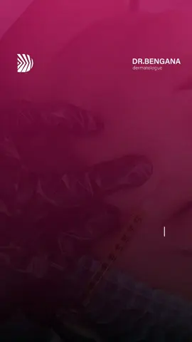 #mesotherapie  #vampirefacial  #dermatologueconstantine #alimendjeli_constantine #algerie🇩🇿 #filler #botox 