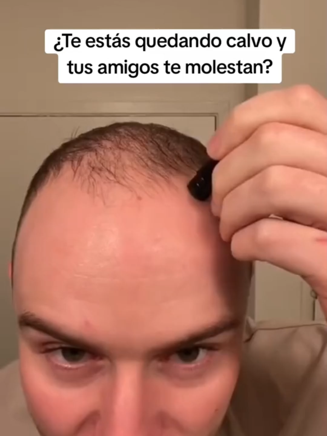 🧴💚 Cuida tu cabello desde la raíz Descubre el poder del Tónico Capilar OUHOE con ingredientes naturales 🌿 💪 El tónico Elhoe estimula el crecimiento y fortalece tu pelo ✨ Notarás menos caída y más fuerza con el uso regular 🚚 Envío gratis a toda Colombia 💵 Pago contra entrega 👉 ¡Haz clic y pide el tuyo ahora! #barba #belleza #crescimiento#contraentrega #enviogratis #cuidadocapilar#cabellofuerte#cuidatucabello#bellezacolombiana