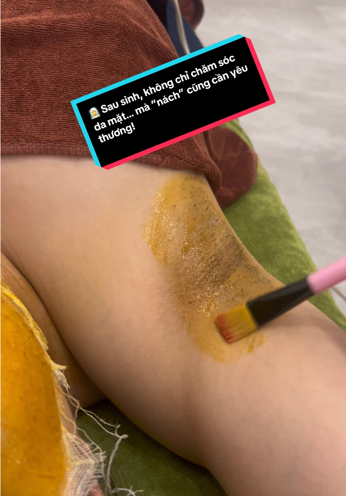 🧖‍♀️ Sau #sinh, không chỉ chăm sóc da mặt… mà “nách” cũng cần yêu thương! ✨ Thâm – mùi – sạm màu là chuyện thường gặp sau sinh, nhưng đừng lo! Cô chăm sóc sẽ giúp mẹ: ✅ Làm sáng vùng da dưới cánh tay ✅ Hết mùi  ✅ Tự tin mặc áo dây, áo sát nách trở lại! #ChămSócSauSinh#ChămSócMẹSauSinh #xuhuongtiktok #xuhuong #xuhuongtiktok  