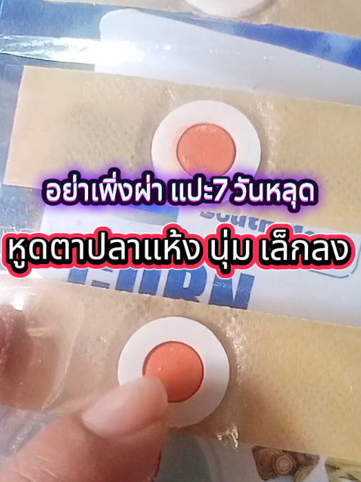 #หูดตาปลา #วิธีกําจัดหูดตาปลา #ที่แปะตาปลา  #แผ่นแปะตาปลา #พิกัดของถูก #พิกัดสินค้าอยู่ในตะกร้า 