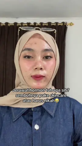 masa iya harus nikah dulu sih😝 #jerawat #acneskin #acnestory #acnefighter #jerawathormonal 