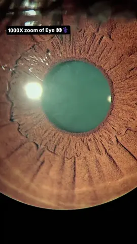 Closer view of our eye with 1000x zoom 😱👀🥶🤯 #retina #oftalmo #ophthalmology #oftalmologia #oftalmología #ophtalmologie #офтальмологія #офтальмология #οφθαλμολογία #ophthalmologists  #eyehealth #vision #eye #zeissbrasil #visulasgreenbrasil #clarusbrasil #retinography #visulas #med #meded #eyedisease #medicalschool #medicalstudent #Science #retina