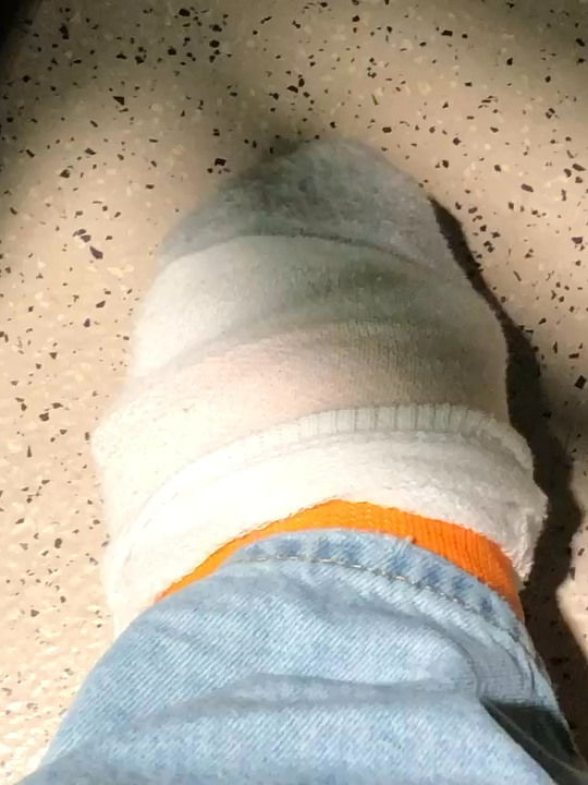 Got to let the toes out to breathe once in a while while in the cast. #orangecast #legcast #cast #brokenleg #brokemyleg #toesout #castedtoes #toes #pinkcast #seemytoes