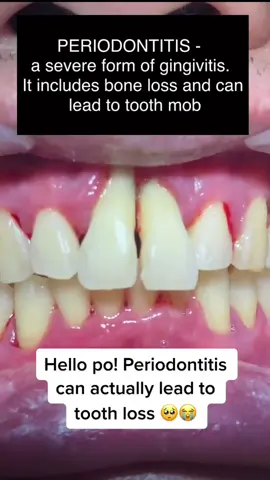 Kreain Nature Oral Care Toothpaste, fresh breath, prevent toothloss, natural ingredients#toothpaste #periodontitis #looseteeth #teeth 