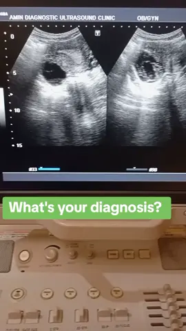 #for_you  #for_you_page  #Radiologist  #Sonologist  #Sonographer  #Medical_students 
