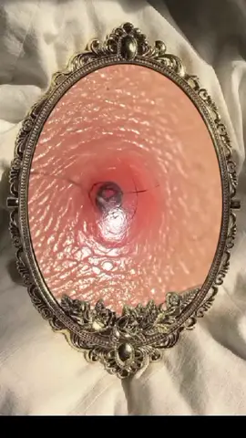 Ingrown hair removal. satisfying removal hair #ingrownhair #ingrown #ingrownhairremoval #ingrowntoenailremoval #fyp #satisfy #asmr #asmrsounds #asmrvideos #trendingvideos #tt #skin #skincare #hair #hairremoval #hairremovalcream #grown #ingrown 