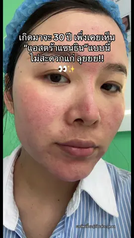 30+ แต่ไม่สะดวกแก่! เลิฟฟAsta drinkของbioactive แพงงแต่โครตดี! #หน้าใส #ป้ายยา #ต้านแก่ #bioactive #astaxanthin #ต้านแก่ชะลอวัย #astadrink 