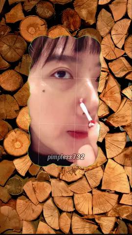 Yes, I’m fine.#pimple #pimplepopping #foryourpage #zithappens #squeezeyuk #zitpop #acne #zit #fyppppppppppppppppppppppp #usatiktok🇺🇸 