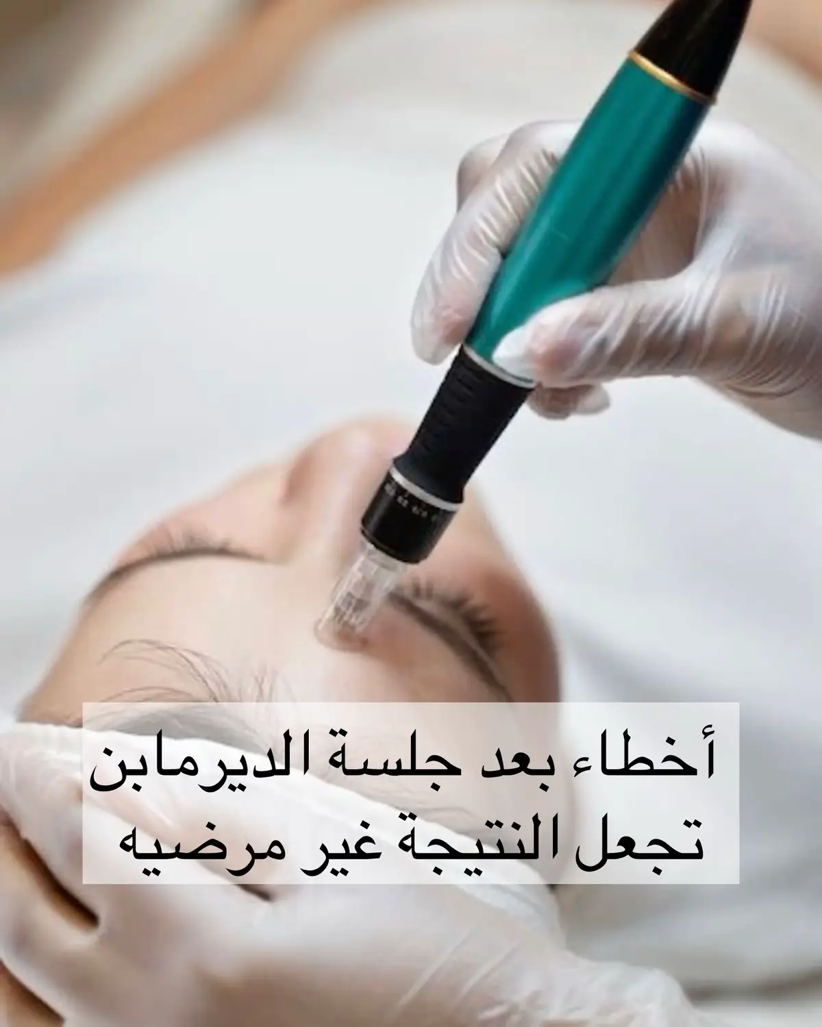 أخطاء بعد جلسة الديرمابن تجعل النتيجة غير مرضيه ❌ #facial #facialtreatment #microneedling #dermapen #healthyskin #glowyskin 