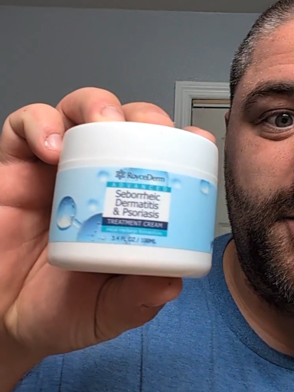Dandruff cream helps manage visible flakes and dry scalp while supporting a cleaner, healthier-looking head of hair. With a lightweight, non-greasy formula, it’s perfect for soothing scalp irritation and reducing buildup without harsh chemicals. Great for anyone tired of constant flaking or itchy scalp struggles. #DandruffRelief #FlakeFreeScalp #NoMoreFlakes #HealthyScalpCare #ItchyScalpSolution #TikTokHairFix #ScalpCareRoutine #HairCareEssentials #SmoothScalp #DandruffCare
