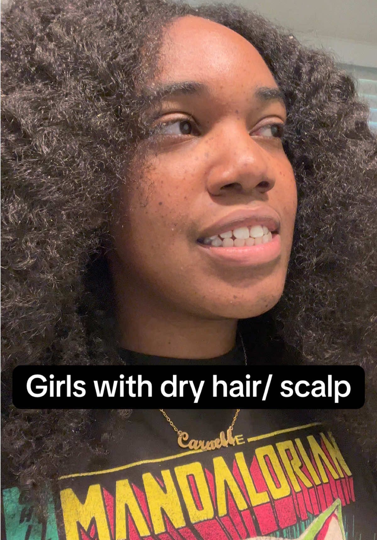 All my dry scalp girlies let me know what do yall be using for your scalp🧖🏾‍♀️ #dryhair #dryhairtips #dryscalp #hair #hairtok #blackgirlhair #blackgirlhairtok #fyp #fypシ #foryoupage #foryourpage 